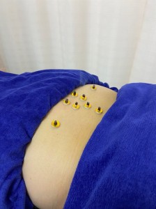 お灸３